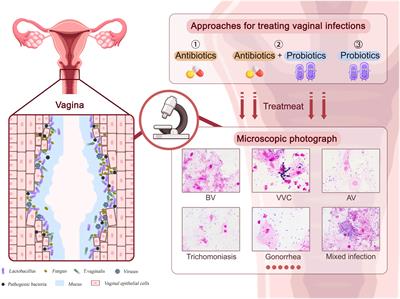 Use of probiotic lactobacilli in the treatment of vaginal infections: In vitro and in vivo investigations